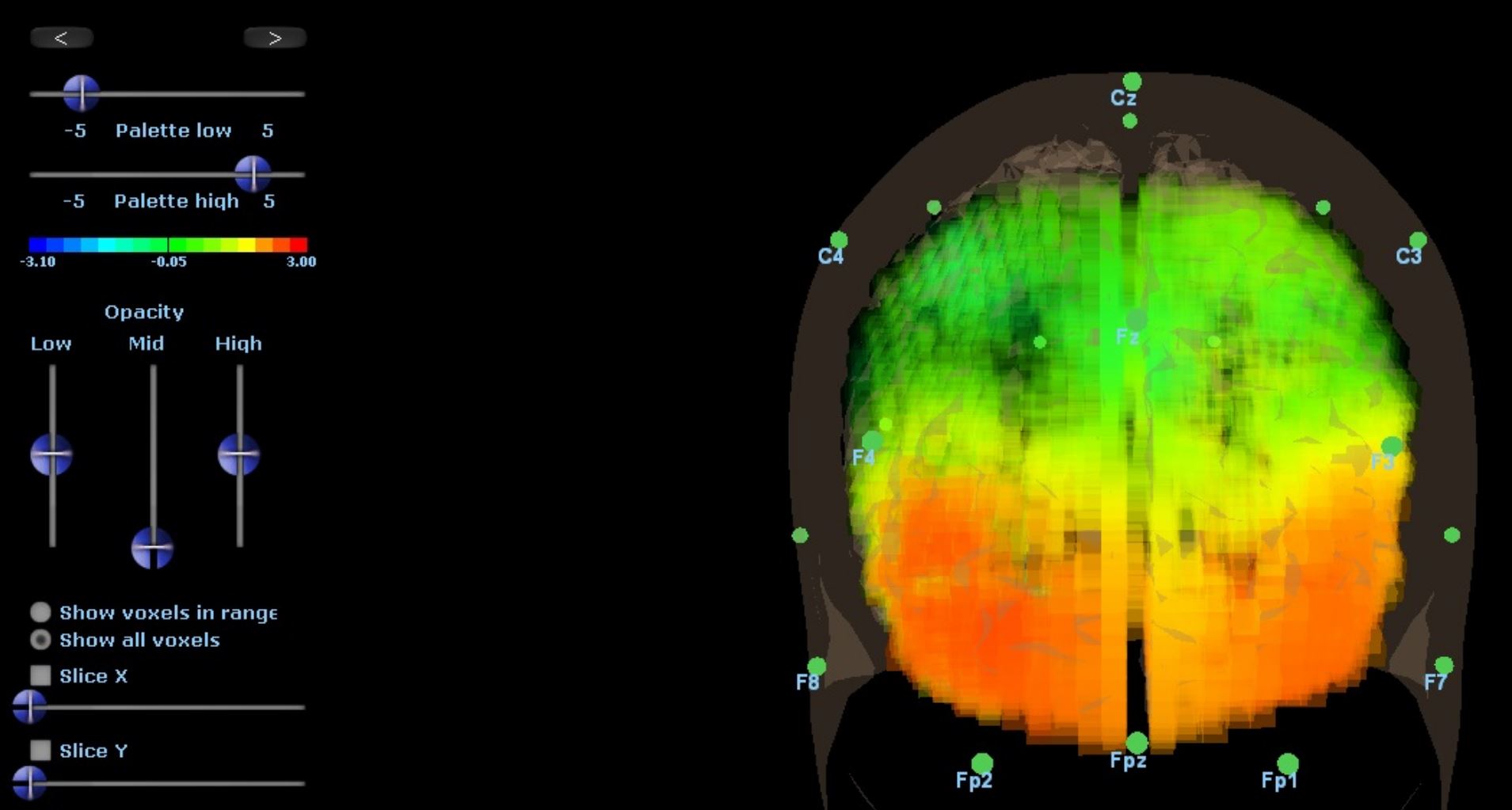 Brain Avatar EEG Biofeedback